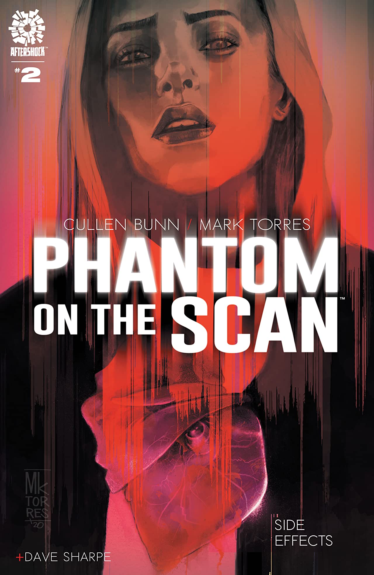 Phantom on the Scan #02